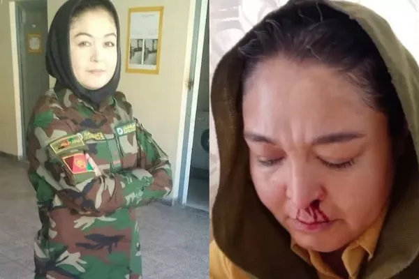 زندگی در جهنم زیر حاکمیت طالبان؛ زن افغانستانی روایت شکنجه و ازدواج اجباری را بازگو کرد