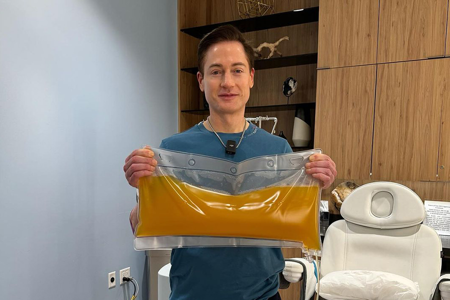 میلیونر امریکایی که می‌خواهد از ۴۷ سالگی به ۱۸ سالگی بازگردد، طلای مایع بدنش را جایگزین کرد