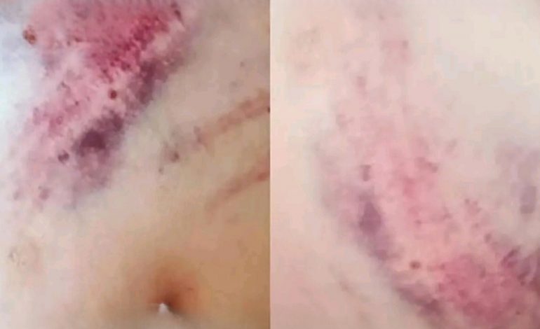 زنی به طالبان اجازه نداد بدنش را تلاشی کنند، به شدت لت‌وکوب شده است