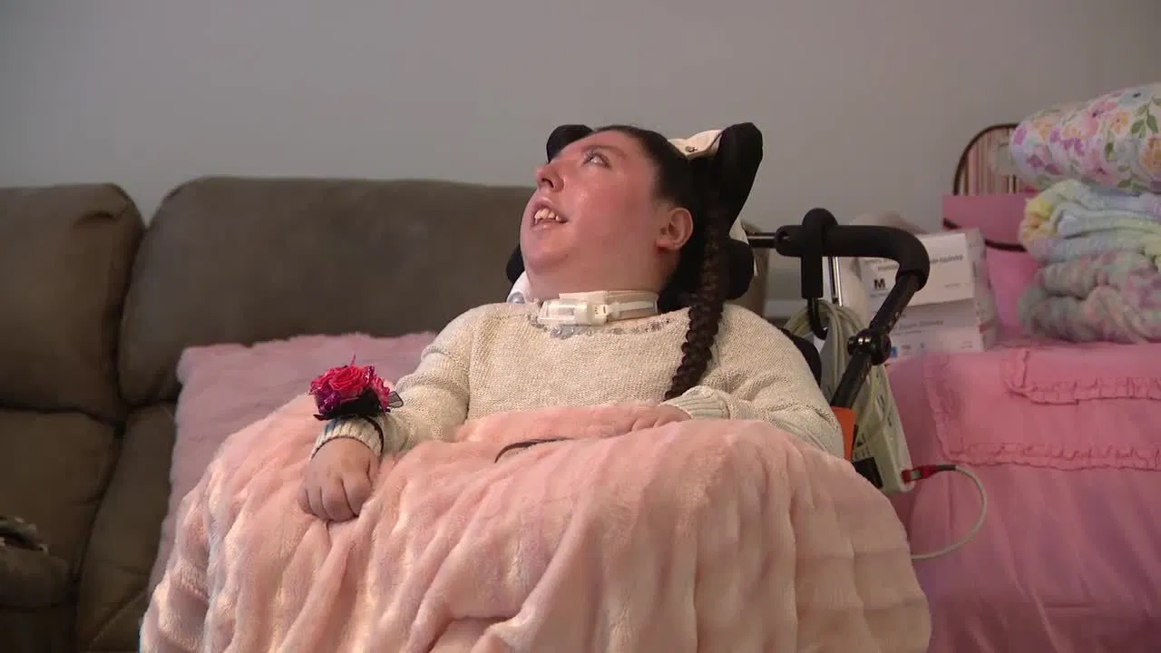 دختر امریکایی ۲۰ سال بدون مغز زندگی کرده است